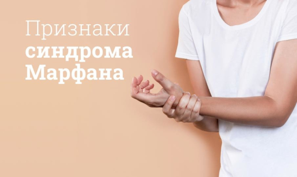 Синдром Марфана &mdash; патология и лечение