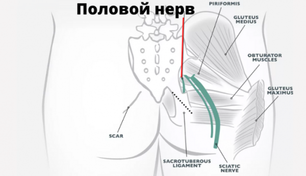 Защемление и нейропатия полового нерва &mdash; причины, симптомы, лечение