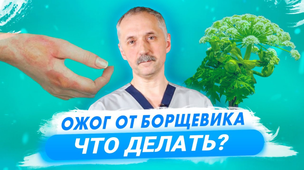 Отравление димексидом — симптомы и лечение Отравление димексидом — симптомы и лечение