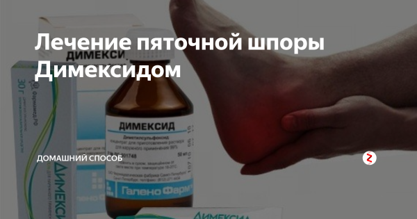 Димексид — эффективное средство от пяточной шпоры Димексид — эффективное средство от пяточной шпоры