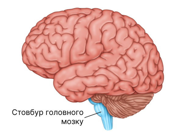 Стволовой инсульт и его прогноз выздоровления Стволовой инсульт и его прогноз выздоровления