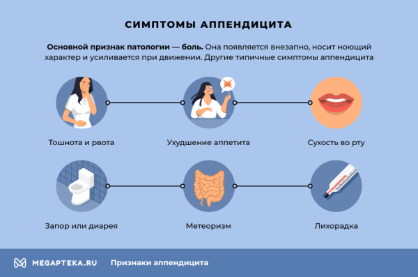 Общие признаки аппендицита и методы диагностики Общие признаки аппендицита и методы диагностики